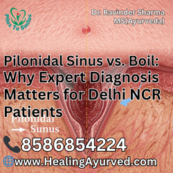Cross-section diagram showing difference between simple boil and complex pilonidal sinus tract for Delhi patients.